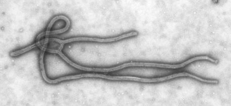 Так выглядит вирус Эбола 
