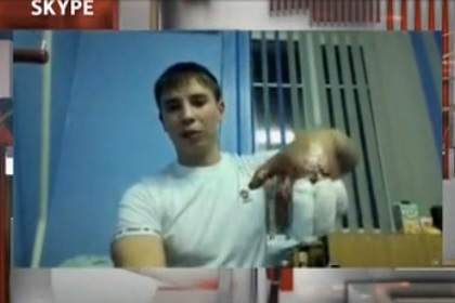 Данил Максудов показывает поврежденные пальцы