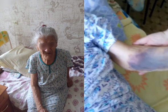 «Превратили в овощ»: Следком проверит, как лечили пенсионерку из Оренбурга, которая скончалась дома после возвращения из больницы 