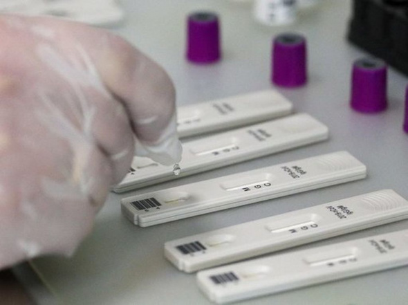 Оренбургская область потратит на закупку экспресс-тестов на коронавирус 20 млн рублей