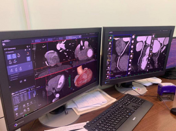 В Орске врачи провели операцию на сонной артерии с применением новой технологии 