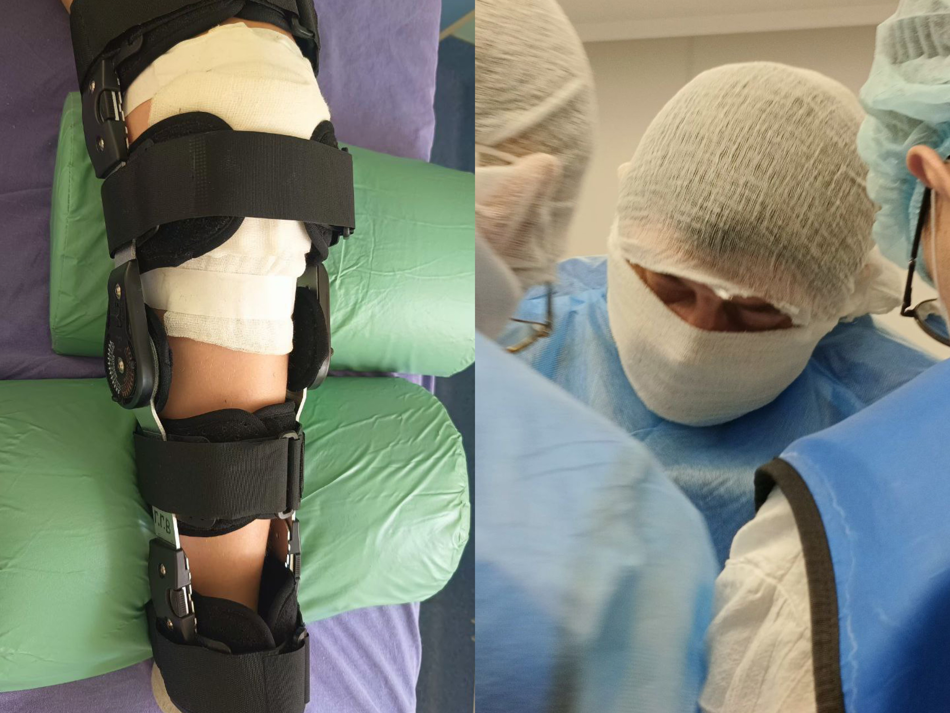 Операция на передней крестообразной связки коленного сустава ребёнку. Фото: Минздрав Оренбургской области