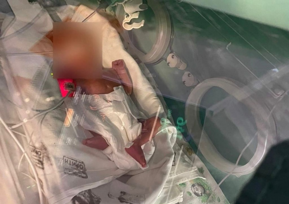 В Оренбурге родился 27-недельный малыш. Его мама и папа попали в аварию, глава семейства погиб