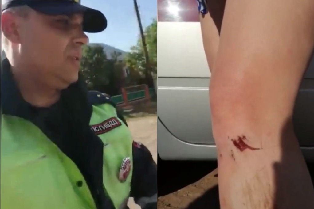 Жительница Сакмары обвиняет сотрудников ДПС в том, что они протащили ее за служебной машиной по дороге