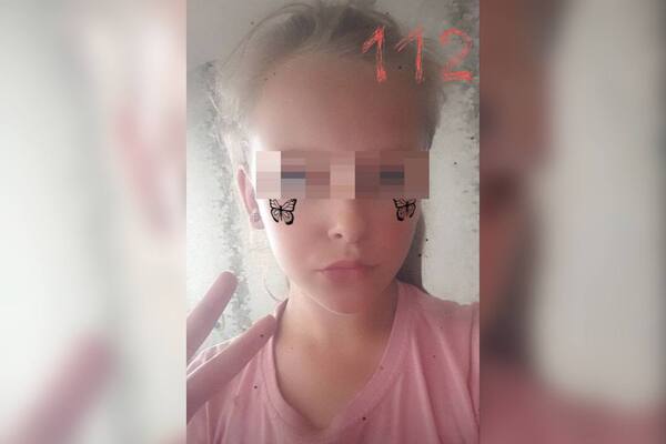 Пострадавшая девочка. Источник: ТГ-канал «112»