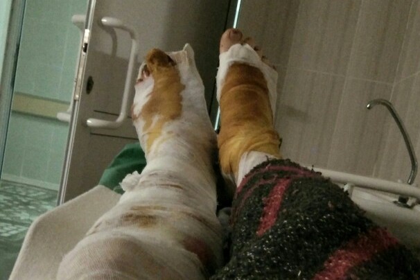 Фото якобы молодого человека, на которого напал тигр