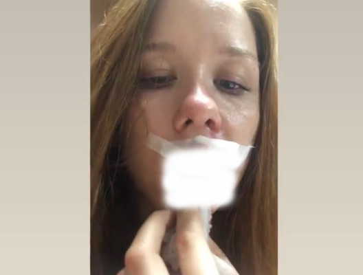 «Теперь я урод без 4-х зубов и со шрамом на лице»: в соцсетях массово распространяется история избитой девушки из Орска (18+)