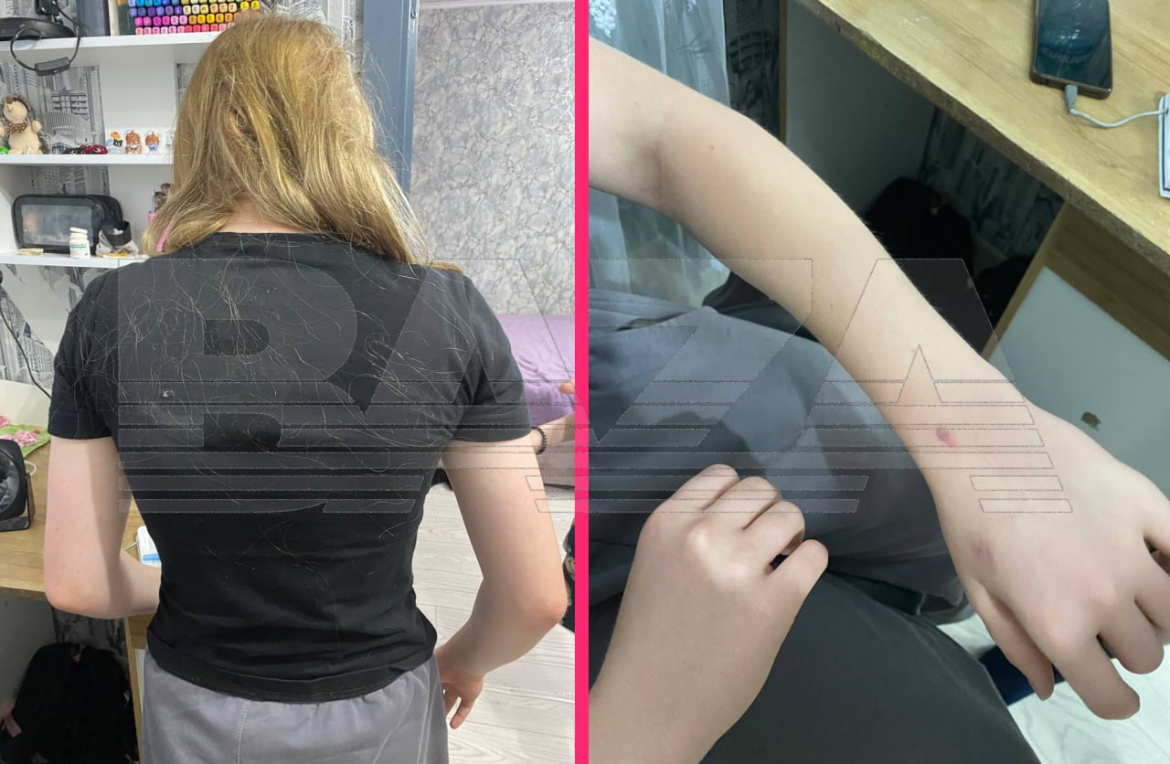 После жестокого избиения 12-летней школьницы. Фото: Baza