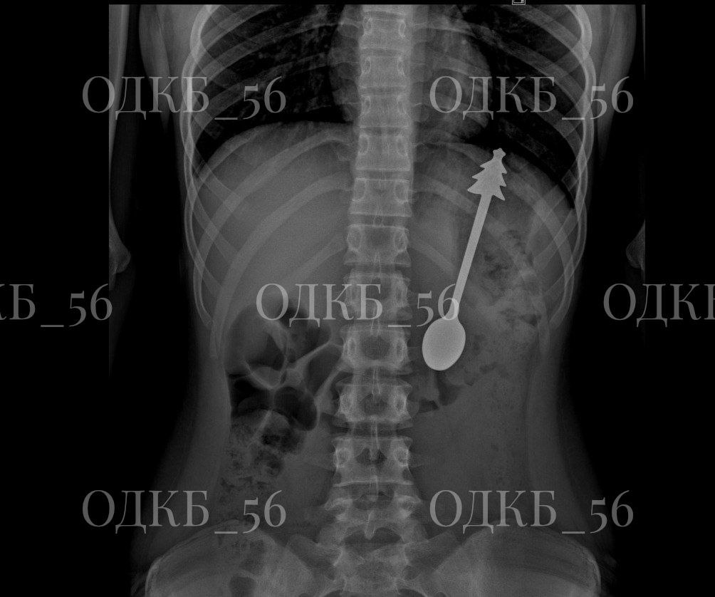 Рентген ребенка. Фото: ОДКБ