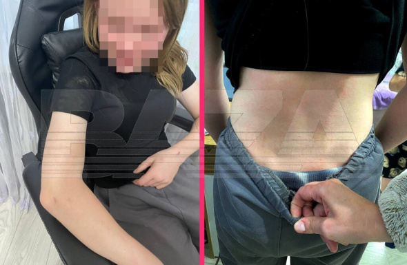 По факту избиения 12-летней девочки в Орске прокуратура внесла представление школе