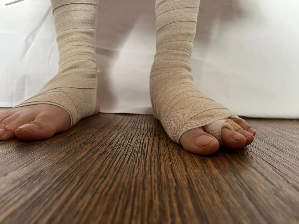 Ноги пациентки. Фото: ОрГМУ