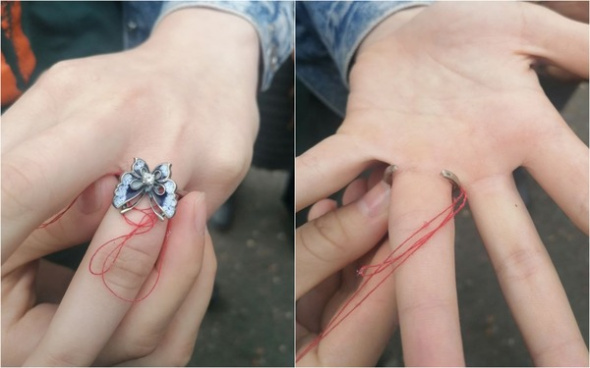 Девушке из Оренбурга спасатели помогли снять кольцо с пальца