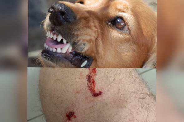 «Шесть прививок от бешенства»: В Оренбурге общественника покусала свора бродячих собак