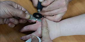 Жительница Оренбурга не смогла снять кольцо и обратилась к спасателям