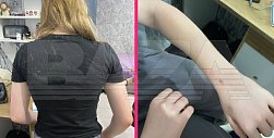 После жестокого избиения 12-летней школьницы. Фото: Baza