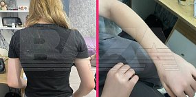 После жестокого избиения 12-летней школьницы. Фото: Baza