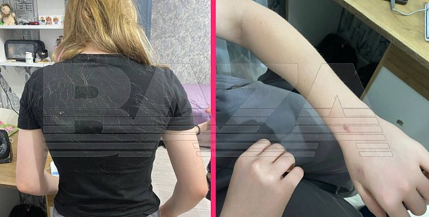 После жестокого избиения 12-летней школьницы. Фото: Baza
