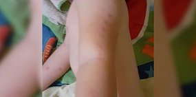 Клопы покусали ребенка? В детском саду Орска не нашли замечаний по санитарному состоянию