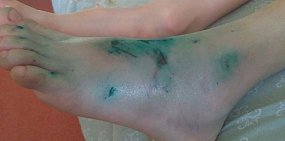 В Оренбурге на набережной Урала бетонная плита упала на ногу ребенку