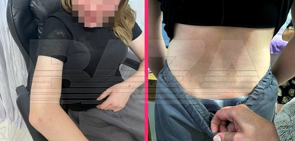 После жестокого избиения 12-летней школьницы. Фото: Baza