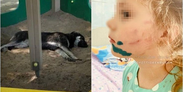 СМИ: В Оренбурге бродячая собака напала на 5-летнюю девочку. Ребенку зашивали щеку