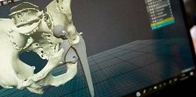 В Оренбурге провели операцию с использованием 3D-печати 