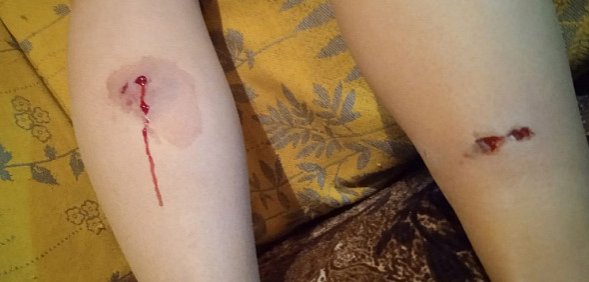 Сходила за хлебушком: Собака покусала жительницу Оренбурга, когда та шла в магазин