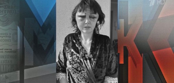 Жительница Бузулука после избиения. Стоп кадр из передачи Мужское/Женское