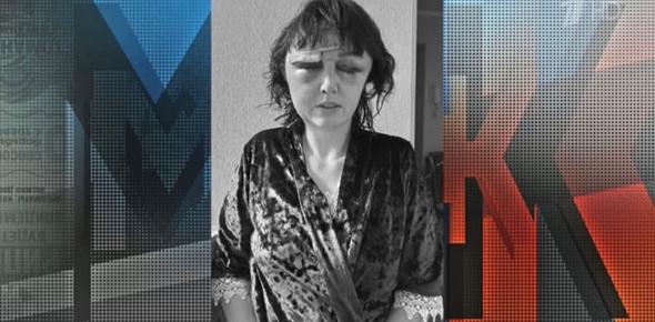 Жительница Бузулука после избиения. Стоп кадр из передачи Мужское/Женское