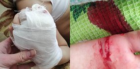 «Девочка визжала так, что слышали два дома»: В соцсетях жители Оренбурга рассказали о нападении бездомной собаки на ребенка 