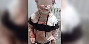 В Новотроицке бродячая собака откусила губу 6-летней девочке
