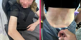 После жестокого избиения 12-летней школьницы. Фото: Baza