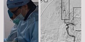 В горбольнице Орска спасли 16-летнего подростка с инсультом