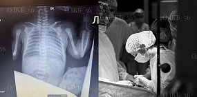 Во время операции. Фото Оренбургской областной клинической больницы. 