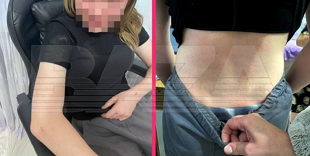 После жестокого избиения 12-летней школьницы. Фото: Baza