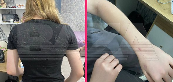 После жестокого избиения 12-летней школьницы. Фото: Baza
