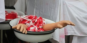 Инсталляция полевого госпиталя «с отрезанными руками» в Оренбурге вызвала массу споров