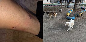 В Орске бродячая собака покусала женщину